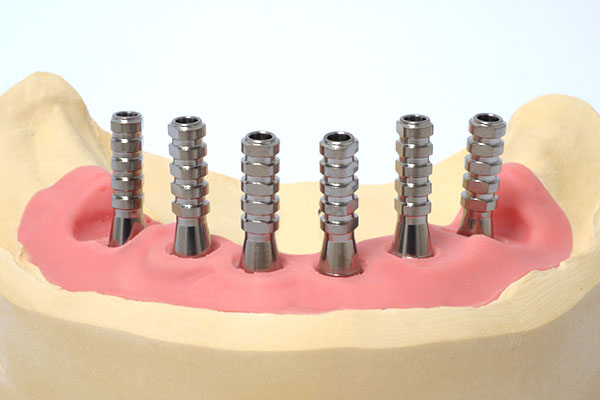 DentaMedics – Implantate